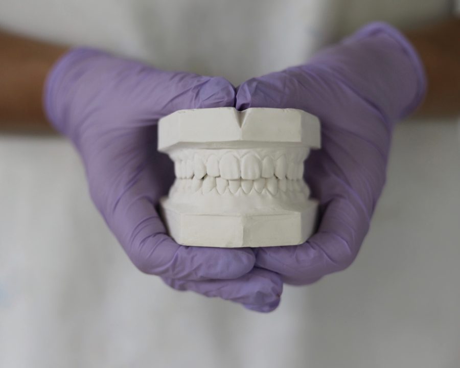 How to Take a Perfect Dental Impression Sentinel Mouthguards®