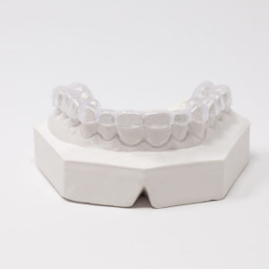 occlusal guard and occlusal splint guide