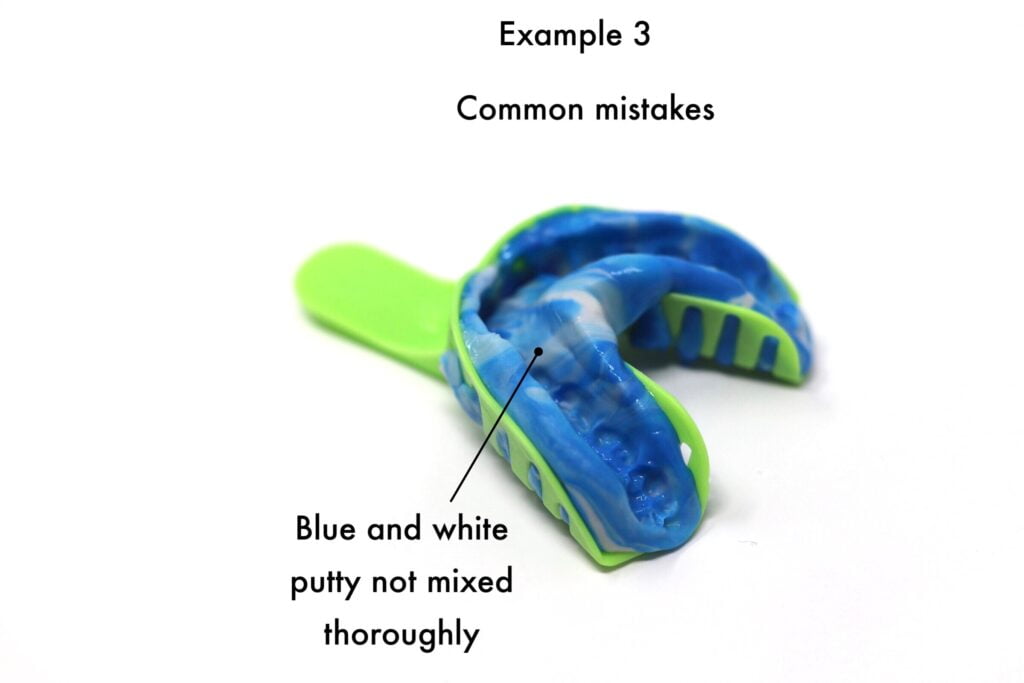 taking dental impression not mixed thoroughly example 3 