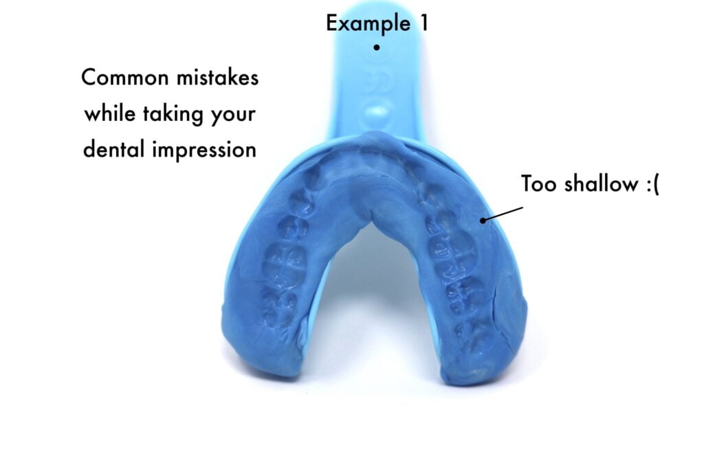 dental impression is too shallow