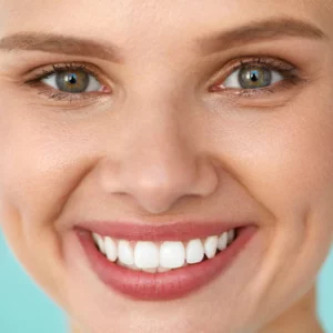 how quickly can I whiten my teeth