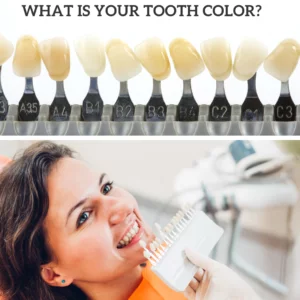 how can i get my teeth white fast