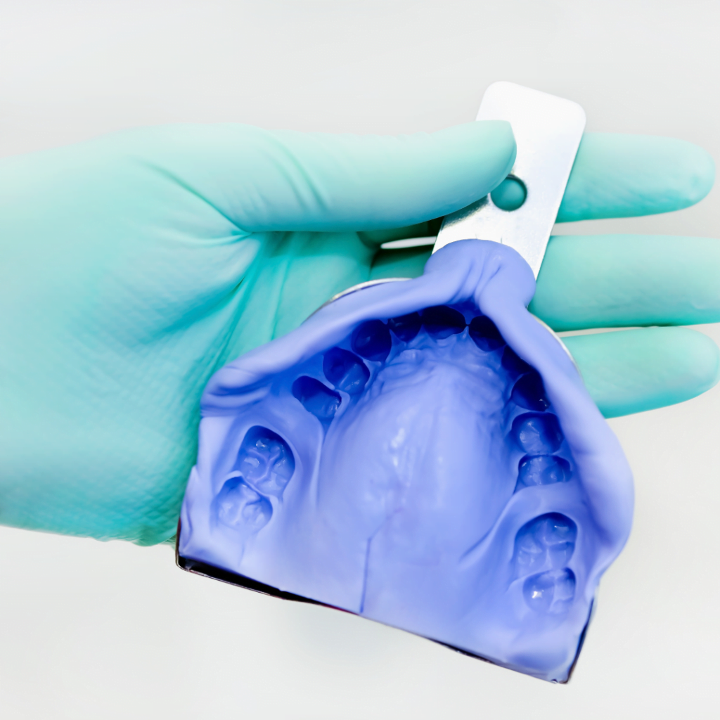 dental impression for sports mouth guard