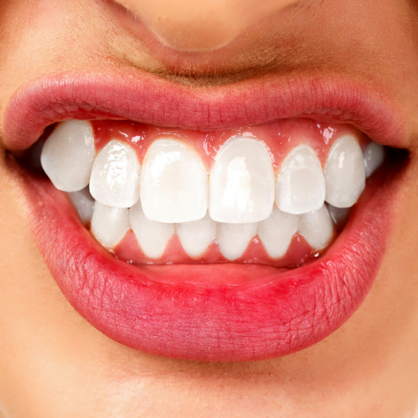 Can having hypothyroidism affect orthodontic treatment?