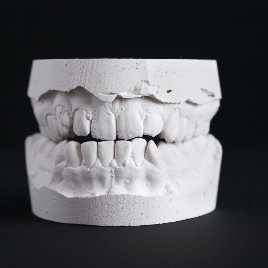 dental mold for custom mouth guard