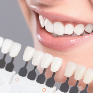 interesting facts about teeth whitening