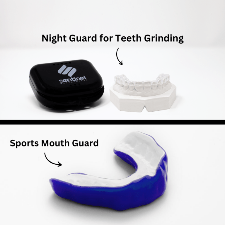 Mouth Guards The Good, The Bad & The Best Sentinel Mouthguards®
