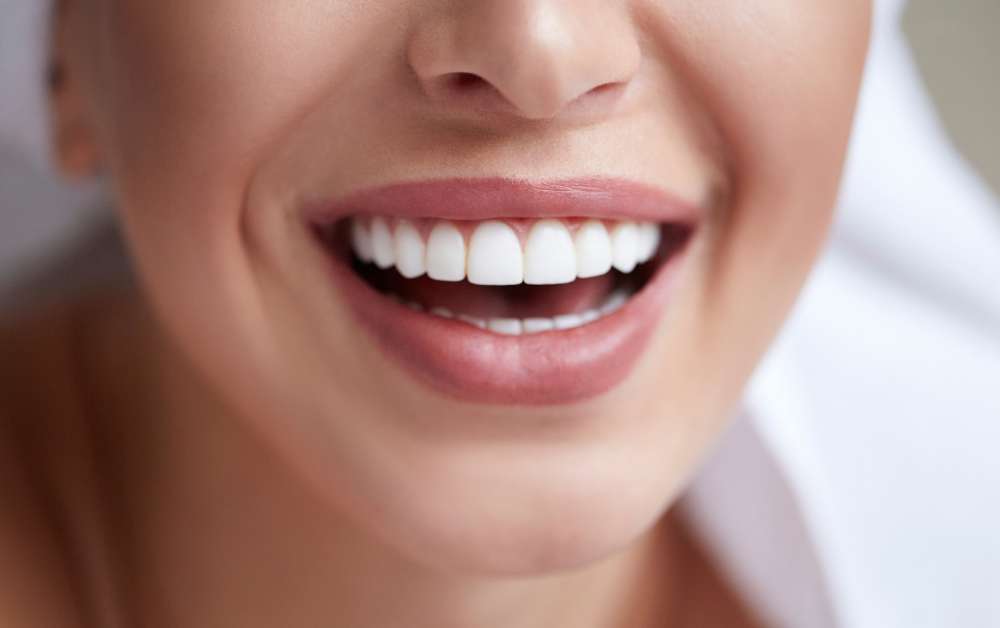 ideal white teeth