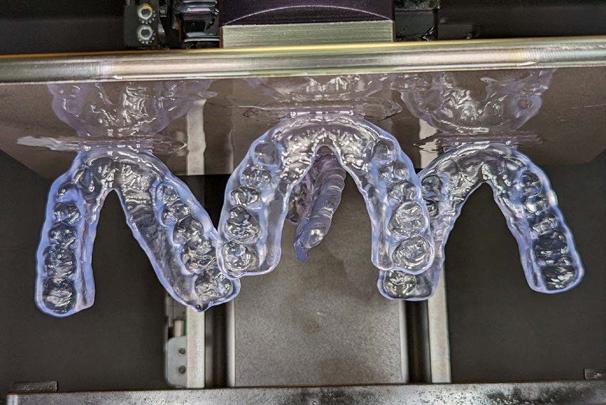 dental night guards 3D printed